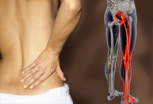 Pain Location Matters: The Impact of Leg Pain on Health Care Use, Work  Disability and Quality of Life in Patients with Low Back Pain –  Chiropractic Resource Organization – largest Chiropractic News Source